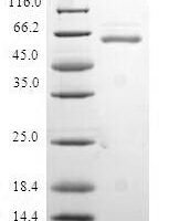 Human Protein quaking (QKI) Recombinant Protein - BioCrest Sci
