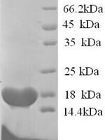 Dog Cholinesterase (BCHE) Recombinant Protein, N-His, aa 1–141, Yeast - BioCrest Sci