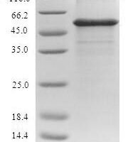 Human Alanine aminotransferase 1 (GPT) Recombinant Protein, N-His/C-His - BioCrest Sci