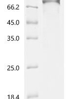 Human Membrane cofactor protein (CD46), partial, Biotinylated Recombinant Protein - BioCrest Sci