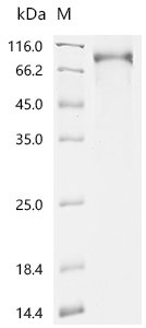 Human Membrane cofactor protein (CD46), partial, Biotinylated Recombinant Protein, Homo sapiens (Human), Mammalian cell, C-terminal mFc-Avi-tagged, 61.8 kDa, purity >≥ 85% as determined by SDS-PAGE.