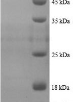 Human Peptide YY protein (PYY), partial Recombinant Protein, N-His - BioCrest Sci