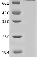 Human Mannan-binding lectin serine protease 1 (MASP1) Recombinant Protein, N-His, aa 20–699, E.coli - BioCrest Sci