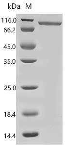 Human Mannan-binding lectin serine protease 1 (MASP1) Recombinant Protein, N-His, aa 20–699, E.coli, E.coli, N-terminal 6xHis-tagged, 83.9 kDa, purity >≥ 85% as determined by SDS-PAGE.