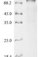 Human Butyrophilin-like protein 2 (BTNL2), partial Recombinant Protein, C-hFc1, aa 24–455 - BioCrest Sci
