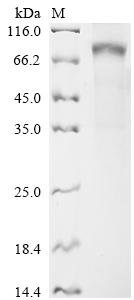 Human Butyrophilin-like protein 2 (BTNL2), partial Recombinant Protein, C-hFc1, aa 24–455, Homo sapiens (Human), Mammalian cell, C-terminal hFc1-tagged, 75.8 kDa, purity >≥ 90% as determined by SDS-PAGE.