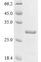 Human E3 ubiquitin-protein ligase RNF43 (RNF43), partial Recombinant Protein, C-His - BioCrest Sci