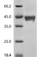 Human Inhibin beta A chain (INHBA) Recombinant Protein, N-His - BioCrest Sci
