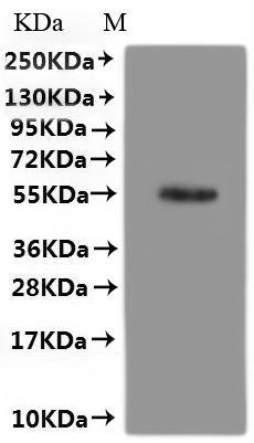 Human Protein spinster homolog 3 (SPNS3)-VLPs Recombinant Protein, Homo sapiens (Human), Mammalian cell, C-terminal 10xHis-tagged(This tag can be tested only under denaturing conditions), 56.1 kDa, purity >≥ 95% as determined by SEC-HPLC.