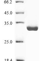 Human Neuropeptide B (NPB) Recombinant Protein - BioCrest Sci