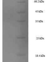 Mouse Heat shock 70 kDa protein 1B (Hspa1b) Recombinant Protein - BioCrest Sci