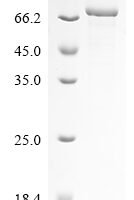 Severe acute respiratory syndrome coronavirus 2 Spike glycoprotein (S), partial Recombinant Protein, N-His - BioCrest Sci