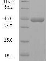 Human Protein phosphatase 1 regulatory subunit 1B (PPP1R1B) Recombinant Protein - BioCrest Sci