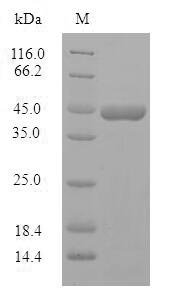 Human Protein phosphatase 1 regulatory subunit 1B (PPP1R1B) Recombinant Protein, Homo sapiens (Human), E.coli, N-terminal GST-tagged, 45.7 kDa, purity >≥ 90% as determined by SDS-PAGE.