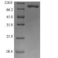 Human Alpha-enolase (ENO1), partial Recombinant Protein - BioCrest Sci