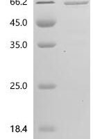 Human Transmembrane protein 100 (TMEM100), Biotinylated Recombinant Protein - BioCrest Sci