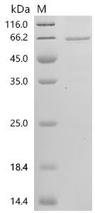 Human Transmembrane protein 100 (TMEM100), Biotinylated Recombinant Protein, Homo sapiens (Human), E.coli, N-terminal MBP-tagged and C-terminal 6xHis-Avi-tagged, 62.2 kDa, purity >≥ 85% as determined by SDS-PAGE.
