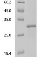 Macaca mulatta Erythropoietin (EPO) Recombinant Protein, C-His - BioCrest Sci