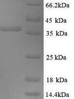 Mouse Excitatory amino acid transporter 2 (Slc1a2), partial Recombinant Protein, N-GST, aa 143–238, Yeast - BioCrest Sci