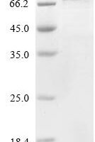 Human Cysteine-rich secretory protein LCCL domain-containing 1 (CRISPLD1) Recombinant Protein - BioCrest Sci
