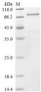 Human Cysteine-rich secretory protein LCCL domain-containing 1 (CRISPLD1) Recombinant Protein, Homo sapiens (Human), in vitro E.coli expression system, N-terminal GST-tagged, 79.7 kDa, purity >≥ 85% as determined by SDS-PAGE.