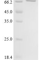 Human T-box transcription factor TBX21 (TBX21) Recombinant Protein - BioCrest Sci