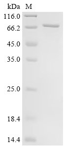 Human T-box transcription factor TBX21 (TBX21) Recombinant Protein, Homo sapiens (Human), E.coli, C-terminal 6xHis-tagged, 65.2 kDa, purity >≥ 85% as determined by SDS-PAGE.