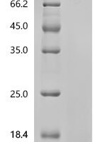 Macaca fascicularis Apolipoprotein C-III (APOC3) Recombinant Protein, C-10His - BioCrest Sci