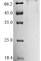 Mouse Mannan-binding lectin serine protease 2 (Masp2) Recombinant Protein, C-His - BioCrest Sci