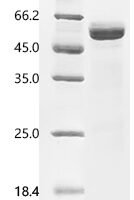 Macaca mulatta Erythropoietin receptor (EPOR), partial Recombinant Protein, C-mFc2a - BioCrest Sci