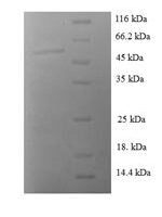 Human 14-3-3 protein sigma (SFN) Recombinant Protein - BioCrest Sci
