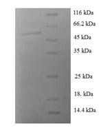 Human 14-3-3 protein sigma (SFN) Recombinant Protein, Homo sapiens (Human), E.coli, N-terminal GST-tagged, 54.8 kDa, purity >≥ 90% as determined by SDS-PAGE.