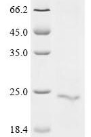 Human Serine protease 1 (PRSS1) Recombinant Protein, C-His, aa 24–247, Baculovirus - BioCrest Sci