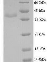 BK polyomavirus Minor capsid protein VP2 Recombinant Protein, N-His, aa 2–351, Yeast - BioCrest Sci
