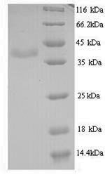 BK polyomavirus Minor capsid protein VP2 Recombinant Protein, N-His, aa 2–351, Yeast, BK polyomavirus (BKPyV), Yeast, N-terminal His-tagged, 40.2 kDa, purity >≥ 90% as determined by SDS-PAGE.