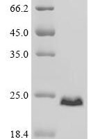 Human Myristoylated alanine-rich C-kinase substrate (MARCKS), partial Recombinant Protein - BioCrest Sci