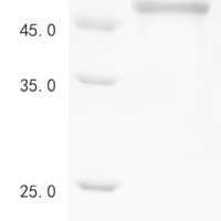 Human Deleted in azoospermia-like (DAZL), partial Recombinant Protein, N-10His-GST/C-V5-Myc - BioCrest Sci