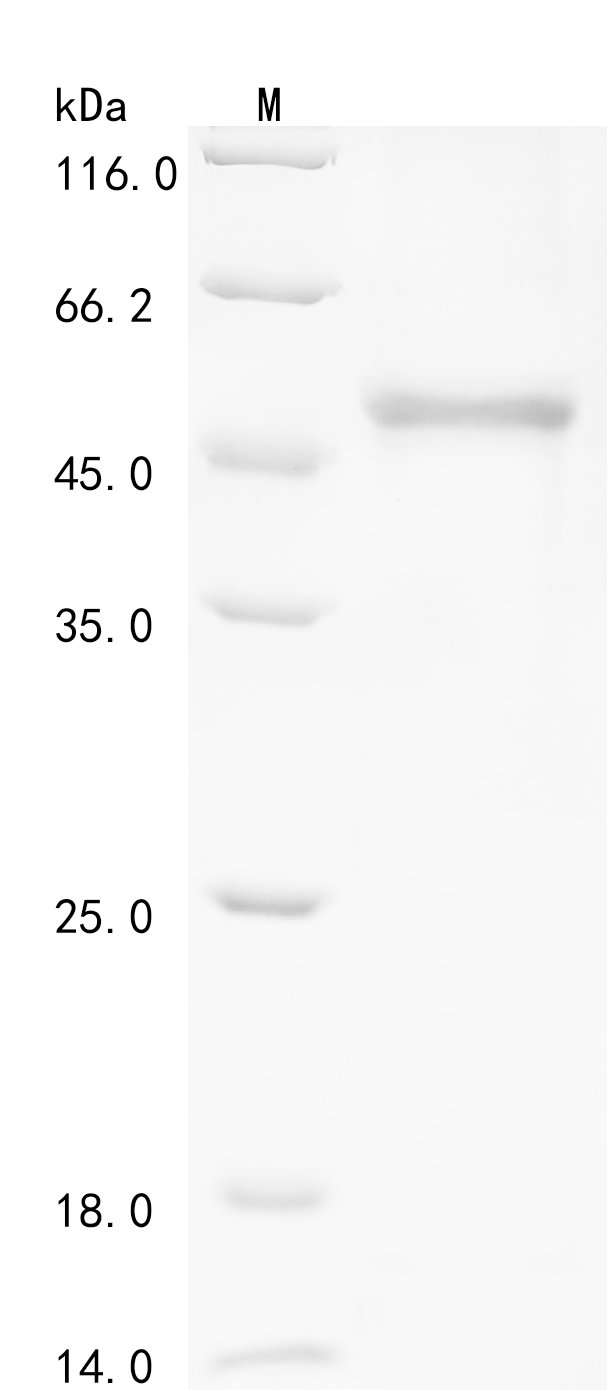 Human Deleted in azoospermia-like (DAZL), partial Recombinant Protein, N-10His-GST/C-V5-Myc, Homo sapiens (Human), E.coli, N-terminal 10xHis-GST-tagged and C-terminal V5-Myc-tagged, 50.2 kDa, purity >≥ 85% as determined by SDS-PAGE.