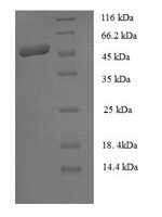 Staphylococcus aureus Staphopain B (sspB) Recombinant Protein - BioCrest Sci