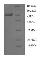Staphylococcus aureus Staphopain B (sspB) Recombinant Protein, Staphylococcus aureus, E.coli, N-terminal GST-tagged, 46.9 kDa, purity >≥ 90% as determined by SDS-PAGE.