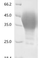 Rat Leukemia inhibitory factor (Lif) Recombinant Protein - BioCrest Sci