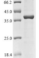 Human Small ribosomal subunit protein eS4, Y isoform 1 (RPS4Y1) Recombinant Protein - BioCrest Sci