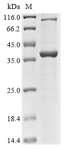 Human Small ribosomal subunit protein eS4, Y isoform 1 (RPS4Y1) Recombinant Protein, Homo sapiens (Human), E.coli, N-terminal 10xHis-tagged and C-terminal Myc-tagged, 36.9 kDa, purity >≥ 85% as determined by SDS-PAGE.