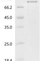 Helicobacter pylori Vacuolating cytotoxin autotransporter (vacA), partial Recombinant Protein, C-His, aa 34–821 - BioCrest Sci