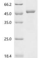 Human Alcohol dehydrogenase 1A (ADH1A) Recombinant Protein - BioCrest Sci
