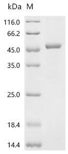 Human Alcohol dehydrogenase 1A (ADH1A) Recombinant Protein, Homo sapiens (Human), E.coli, C-terminal 6xHis-tagged, 46.6 kDa, purity >≥ 95% as determined by SDS-PAGE.
