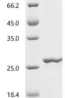 Drosophila melanogaster Profilin (chic) Recombinant Protein, C-10His - BioCrest Sci