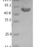 RatTryptophan 2,3-dioxygenaseUniRule annotation (Tdo2) Recombinant Protein - BioCrest Sci
