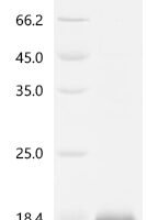Human CCL5/RANTES Recombinant Protein, C-His - BioCrest Sci
