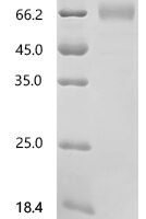 Yarrowia lipolytica ATP citrate synthase Recombinant Protein, C-10His - BioCrest Sci